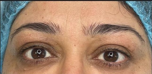Brow shaping before